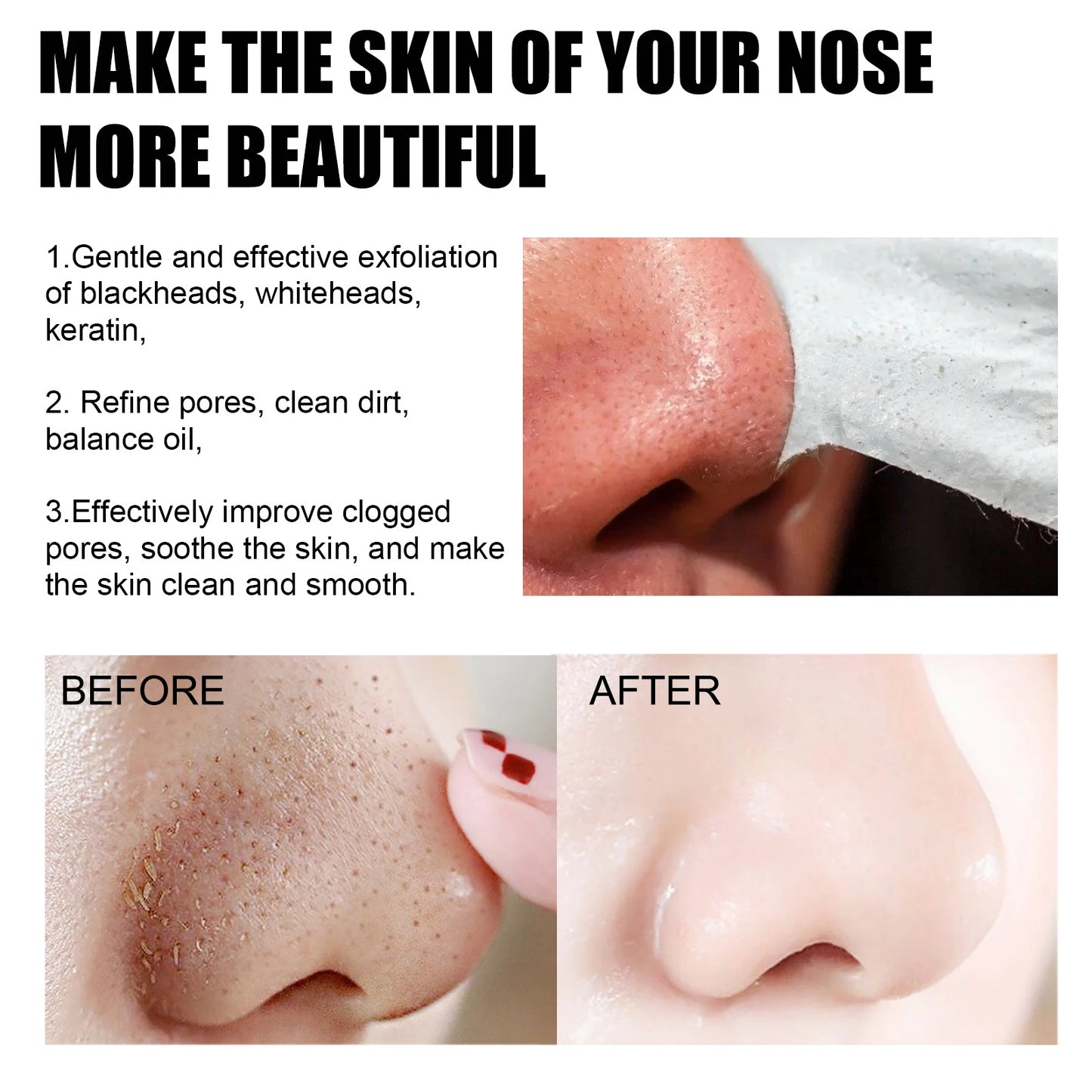 New Blackhead Removal Nose Mask Pore Patch Blackhead Mask Exfoliating Blackhead Deep Cleansing Skin Care Beauty Health