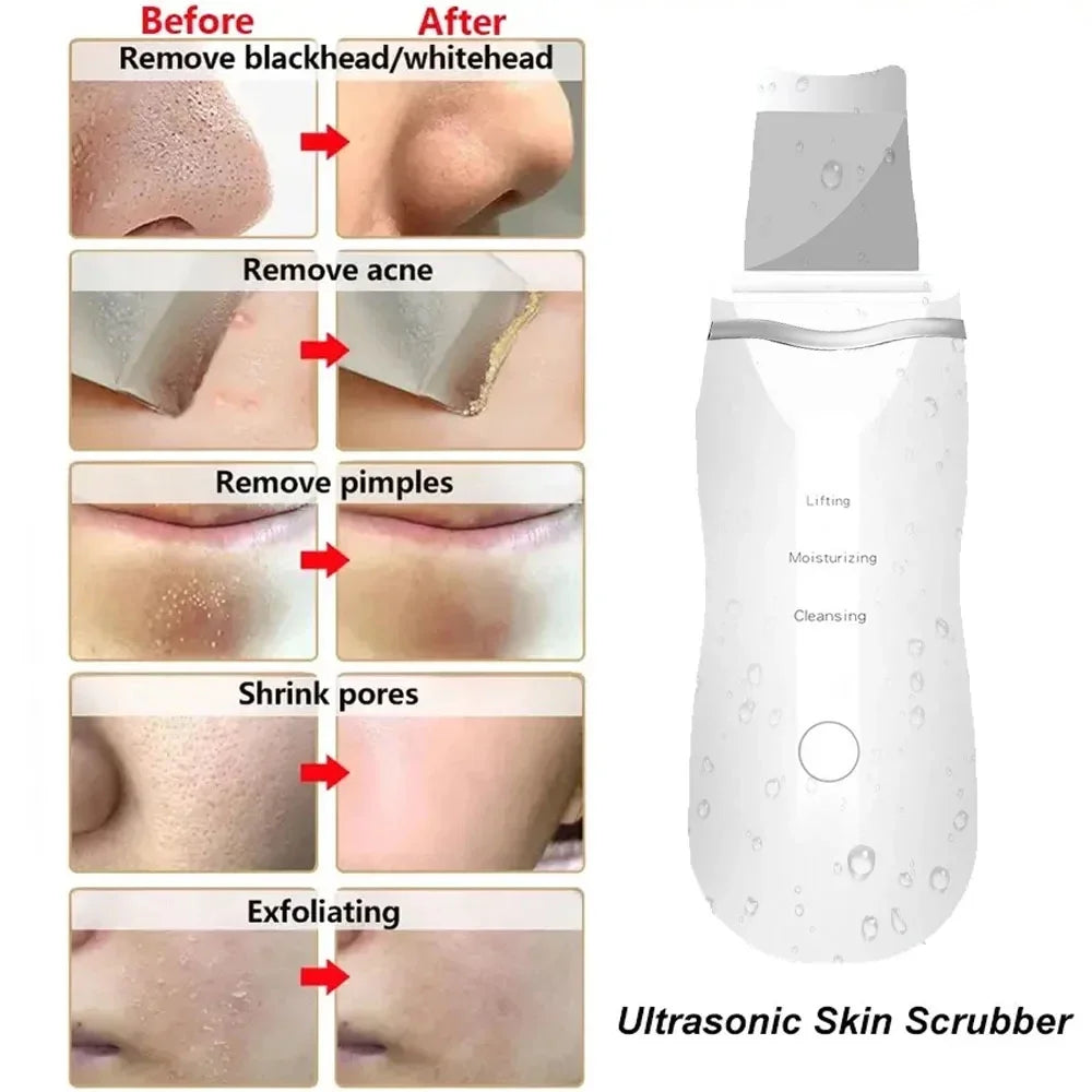 Ultrasonic Skin Scrubber Peeling Blackhead Remover Deep Face Cleaning Acne Pore Cleaner Facial Shovel Cleanser EMS Microcurrent