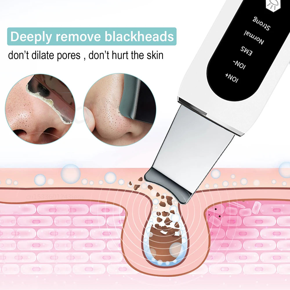 Ultrasonic Skin Scrubber Ultrasonic Deep Face Cleaning Peeling Blackhead Remover Facial Shovel Cleanser Lifting Skin Care